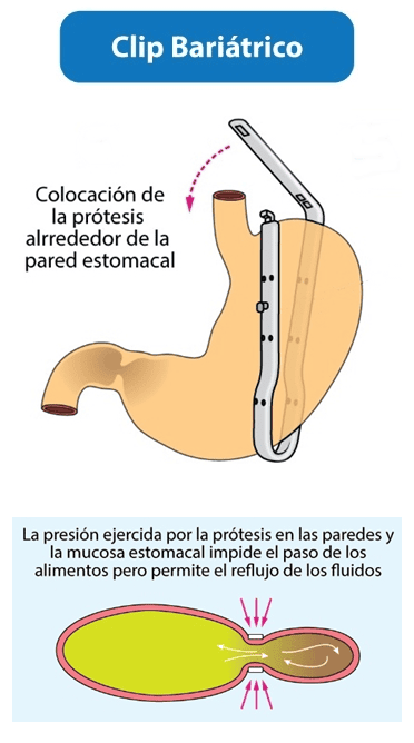 image - Instituto de Obesidad